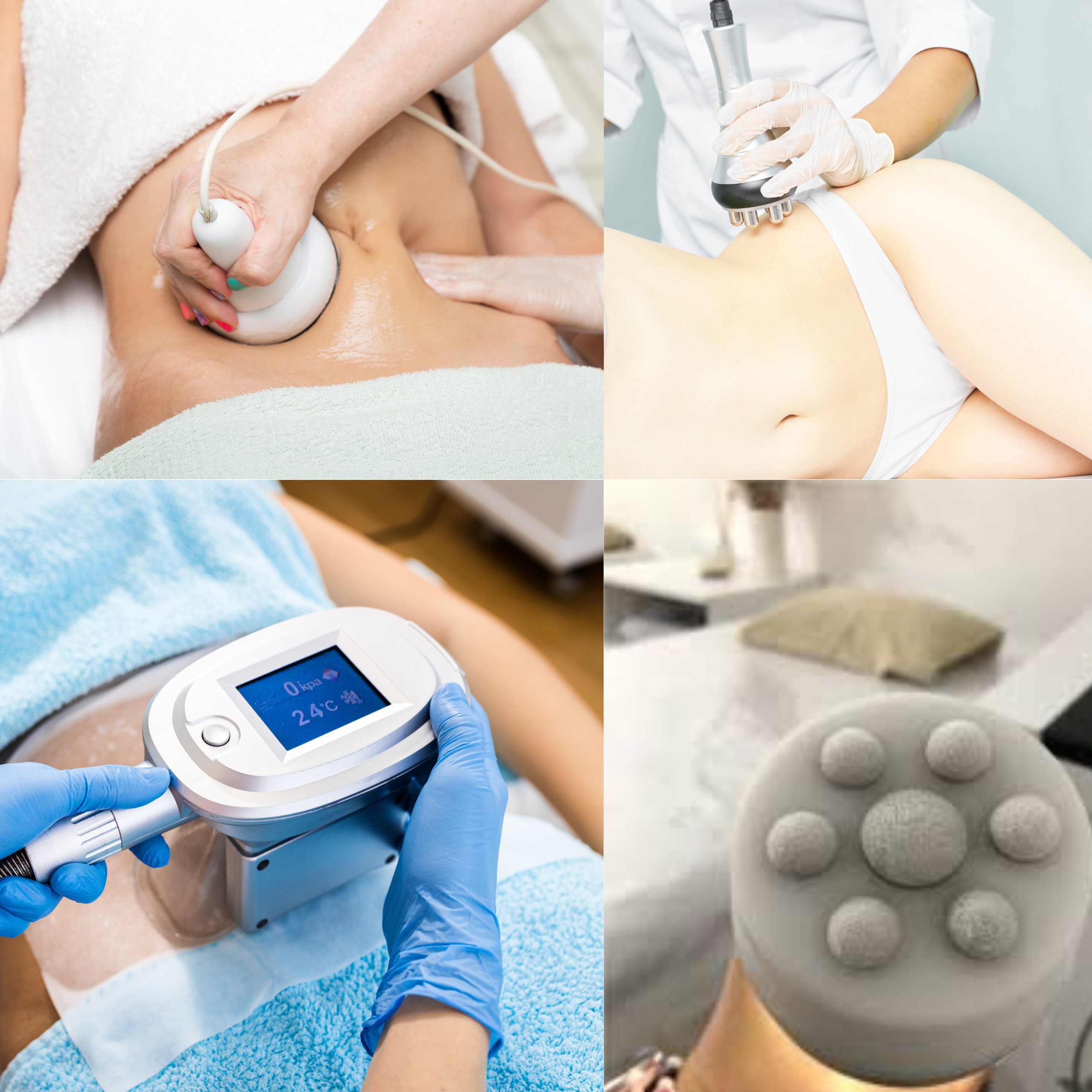 Tecnologías para Grasa Localizada