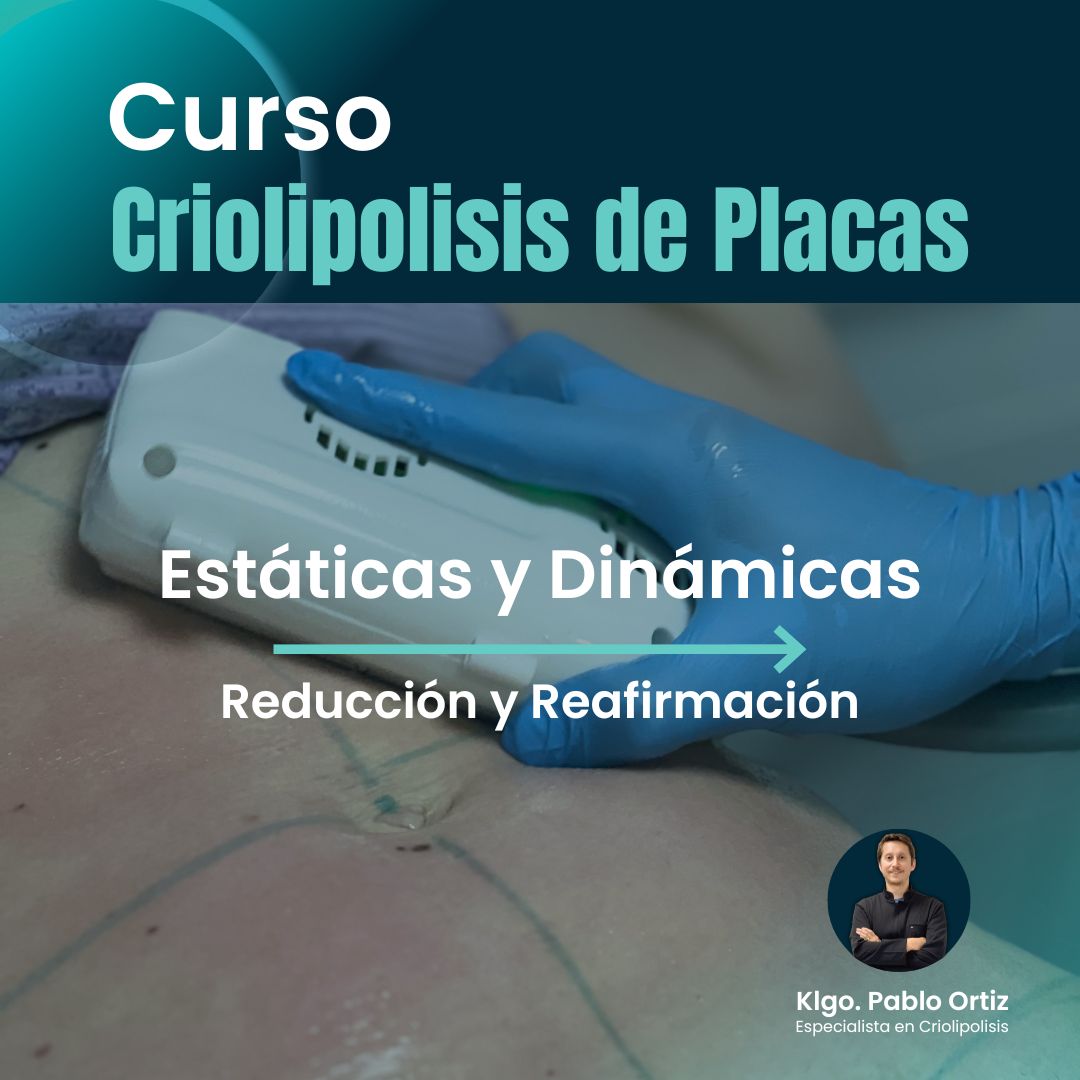 Criolipólisis de Placa